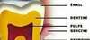 Constitution d'une dent