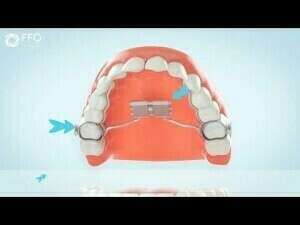 Comment activer son disjoncteur ?