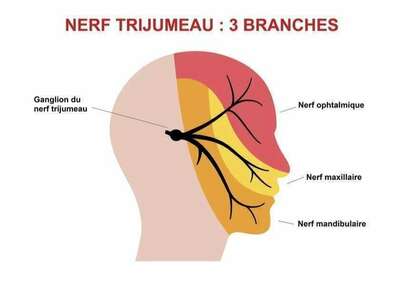 Névralgie du trijumeau et ostéopathie