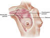 Camille Tejada osteopathe lyon 8 femme cancer sein epaule posture
