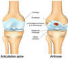 clément donnou ostéo lyon 8 douleur sport sportif genou cheville tendinite entorse arthrose kyste poplité blessure posture