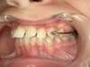 orthodontie chelles