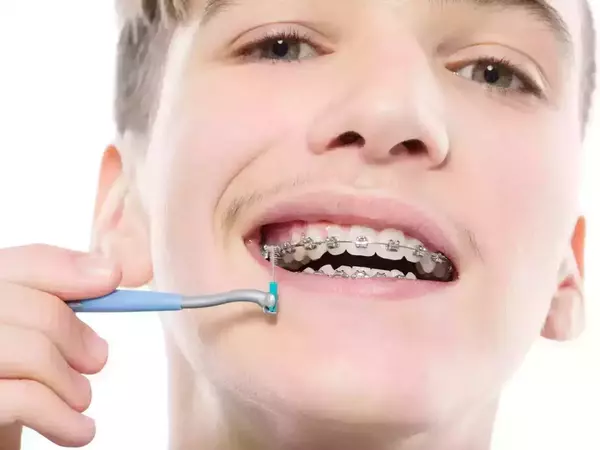 LES 4 REGLES D'OR DE L'ORTHODONTIE