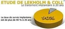 LES IMPLANTS DENTAIRES UN TRAITEMENT FIABLE (IMPLANTS 77)