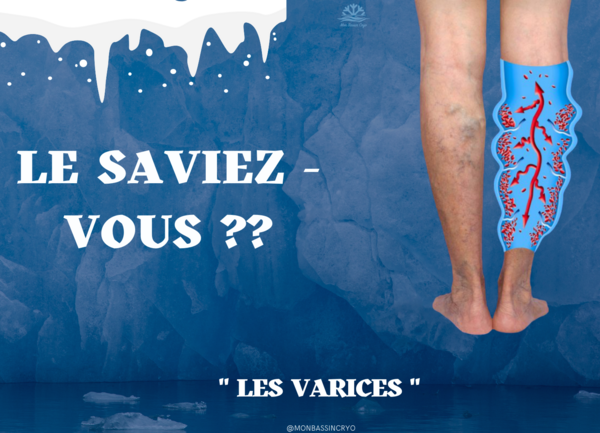 Les varices