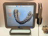 Scanner dentaire numérique précis pour empreinte optique