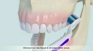 Brossage des dents avec des brackets
