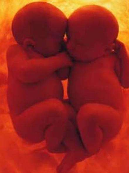 La vie après la naissance