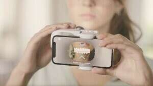 Tutoriel prise de scan - Bagues V1