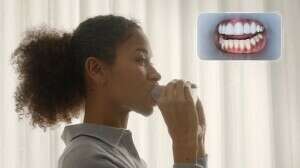 Tutoriel prise de scan - Aligneurs V2