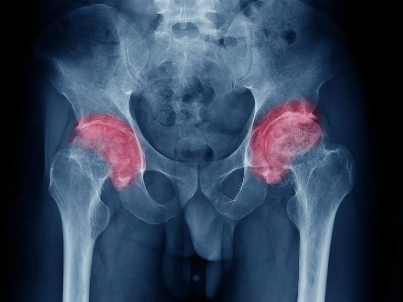 adobestock_214542181