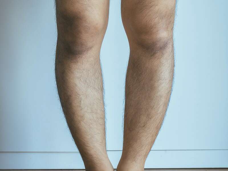 adobestock_211862609az