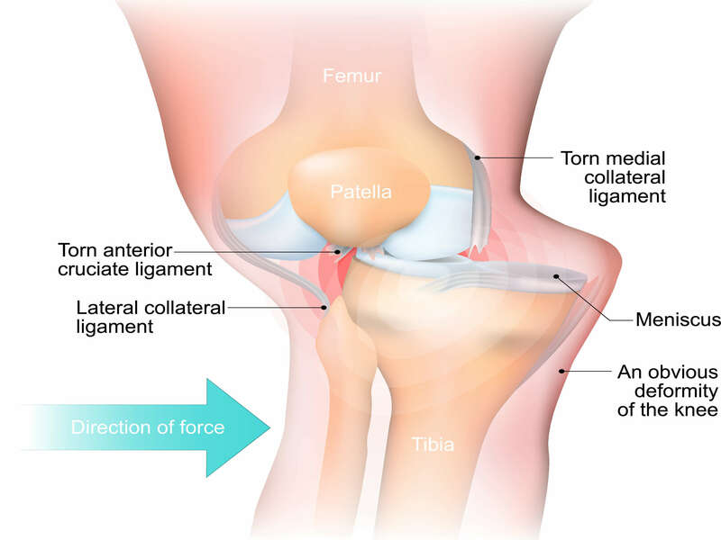 adobestock_141536538