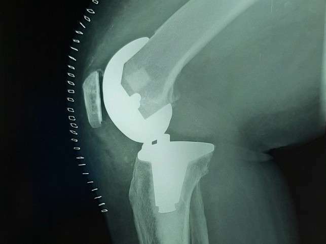 resized_20191007_022737_2