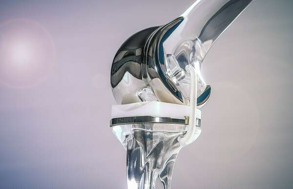 Hypersensibilité aux métaux