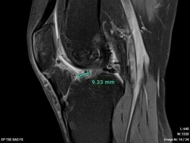 p0088000000050821030210345282148411