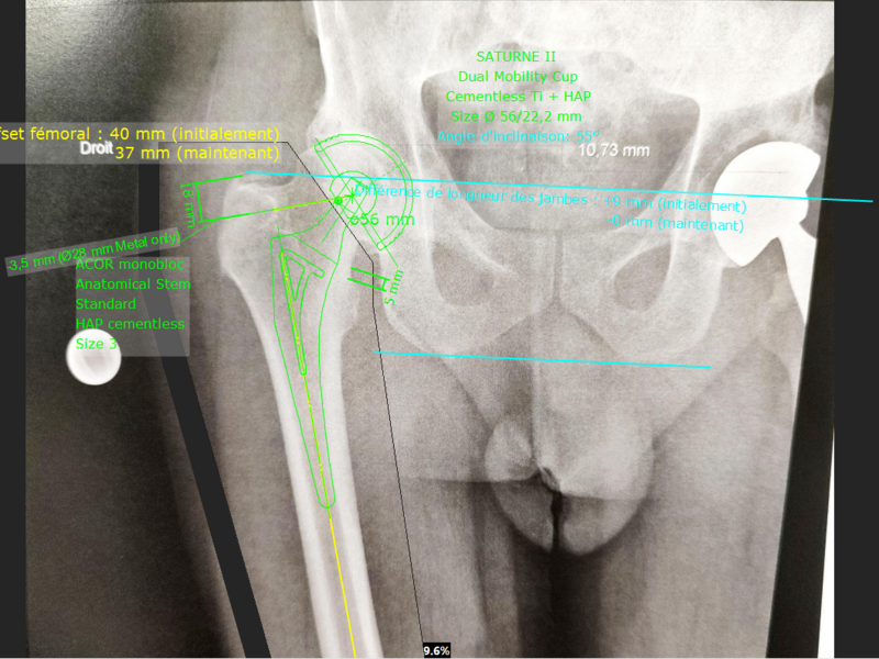 radio_planif_-_moufflet