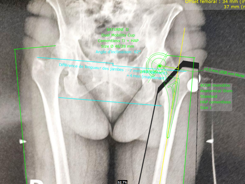 capture_d_ecran_2025-03-30_215929