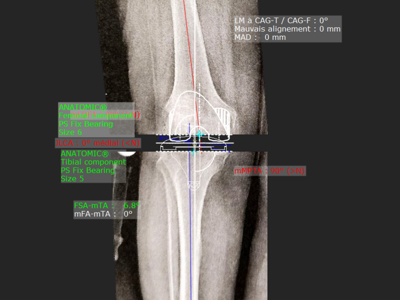 radio_planif_-_schneider