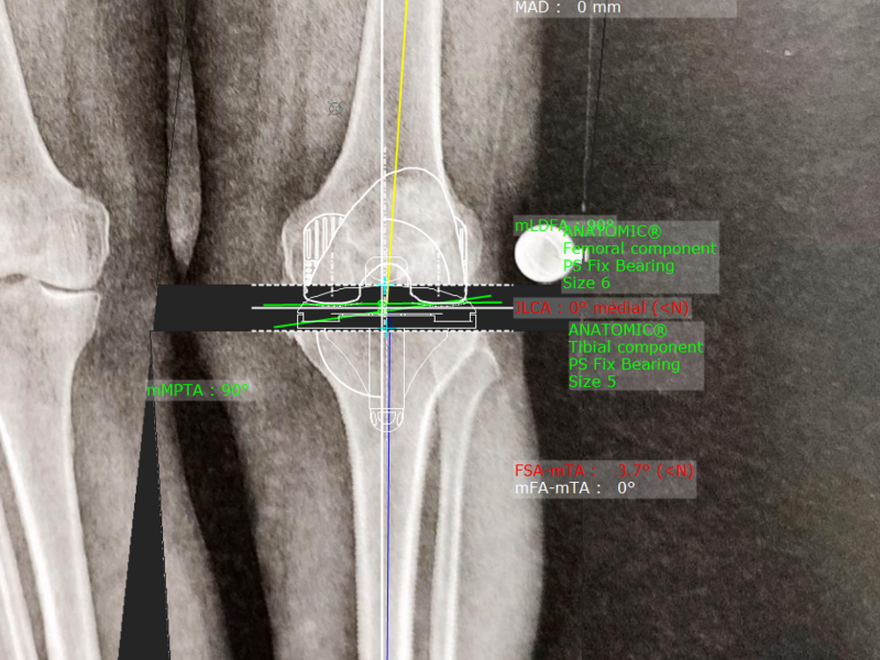 radio_planif_-_moreau