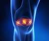 Les Lésions Méniscales