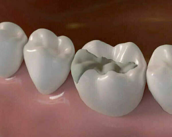 UTILISATION DU LASER EN ODONTOLOGIE