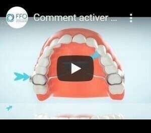 Commenrt activer son disjoncteur?