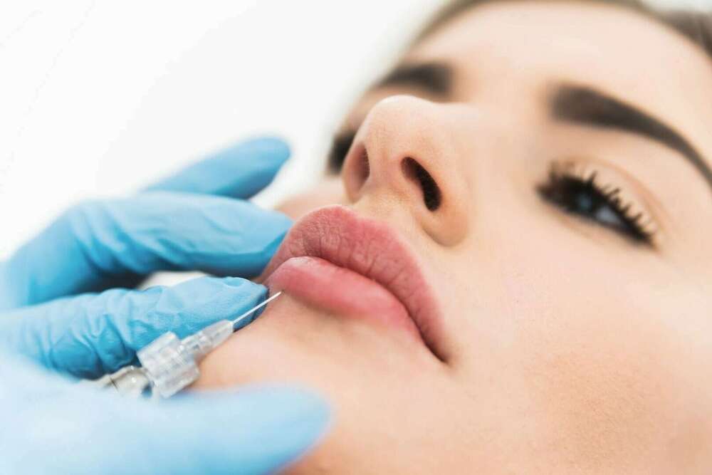 Injection d'acide hyaluronique