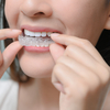 Traitement orthodontique actif, Auvers-sur-Oise