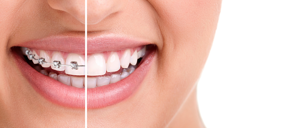 L'Origine des problèmes orthodontiques