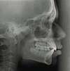 radiographie profil