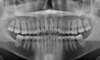 radiographie face