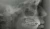 radiographie profil