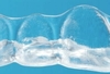 Gouttière transparente
