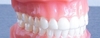 Gouttière transparente