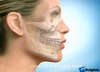 CHIRURGIE BI-MAXILLAIRE