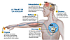 Fibromyalgie et douleur