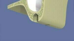 Le comblement de sinus par abord crestal et pose d'implant