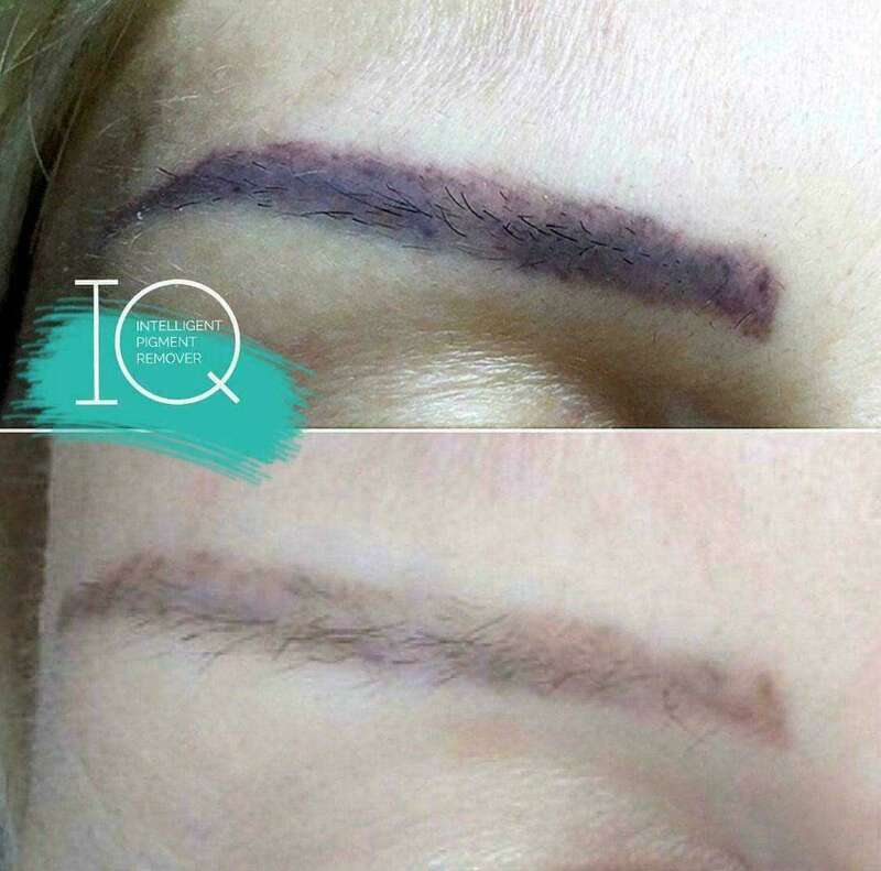 img-20200711-wa004320240120-1876709-14h43ix