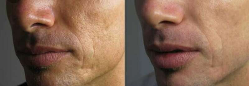 screenshot_20190318-205611_google20240120-1876709-907lki