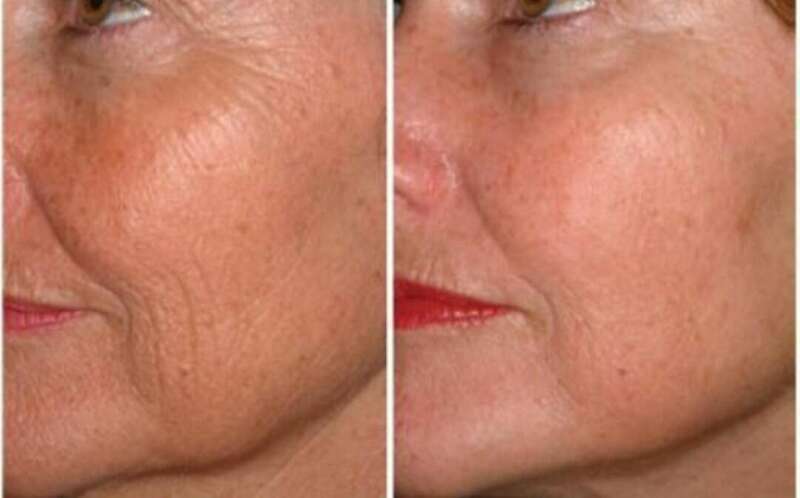 screenshot_20190322-114620_google20240120-1876709-144ox47