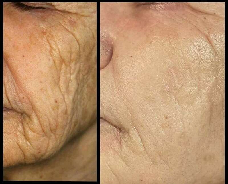 20201201_23354020240120-1876754-1irfz8m