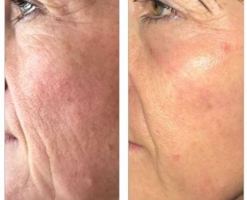 20210403_16204920240120-1876754-1eg7n3v