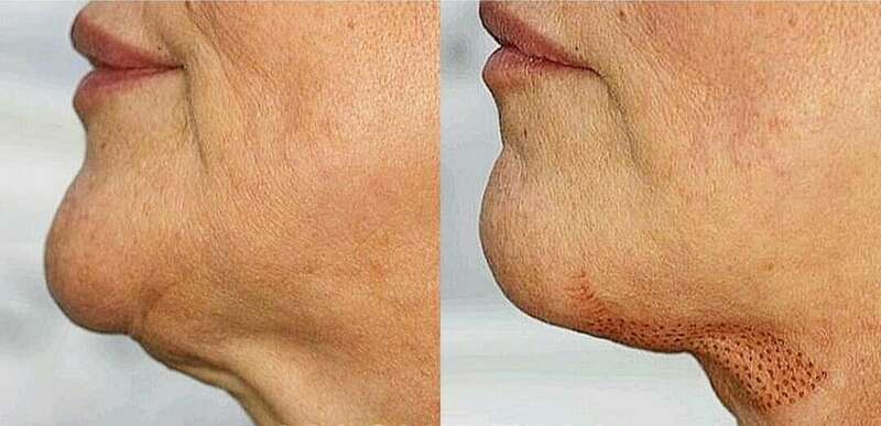 20210403_16214520240120-1876754-1nzji1p