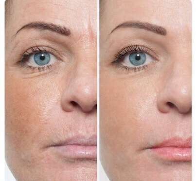 img-20180609-wa000920240120-1876754-jn5zfl