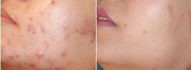 img-20180609-wa000820240120-1876709-19m4pe5