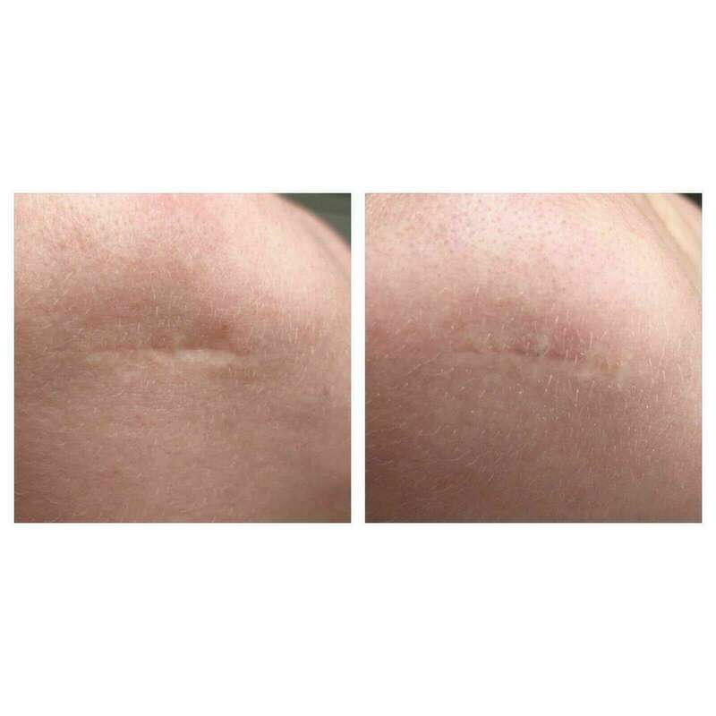 img-20180609-wa001020240120-1876754-lzdl7