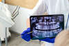 Radiographie dentaire