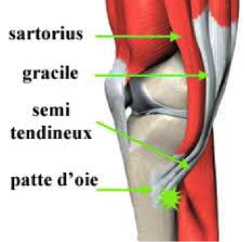 Ostéopathie : tendinite de la patte d’oie