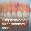 implantologie